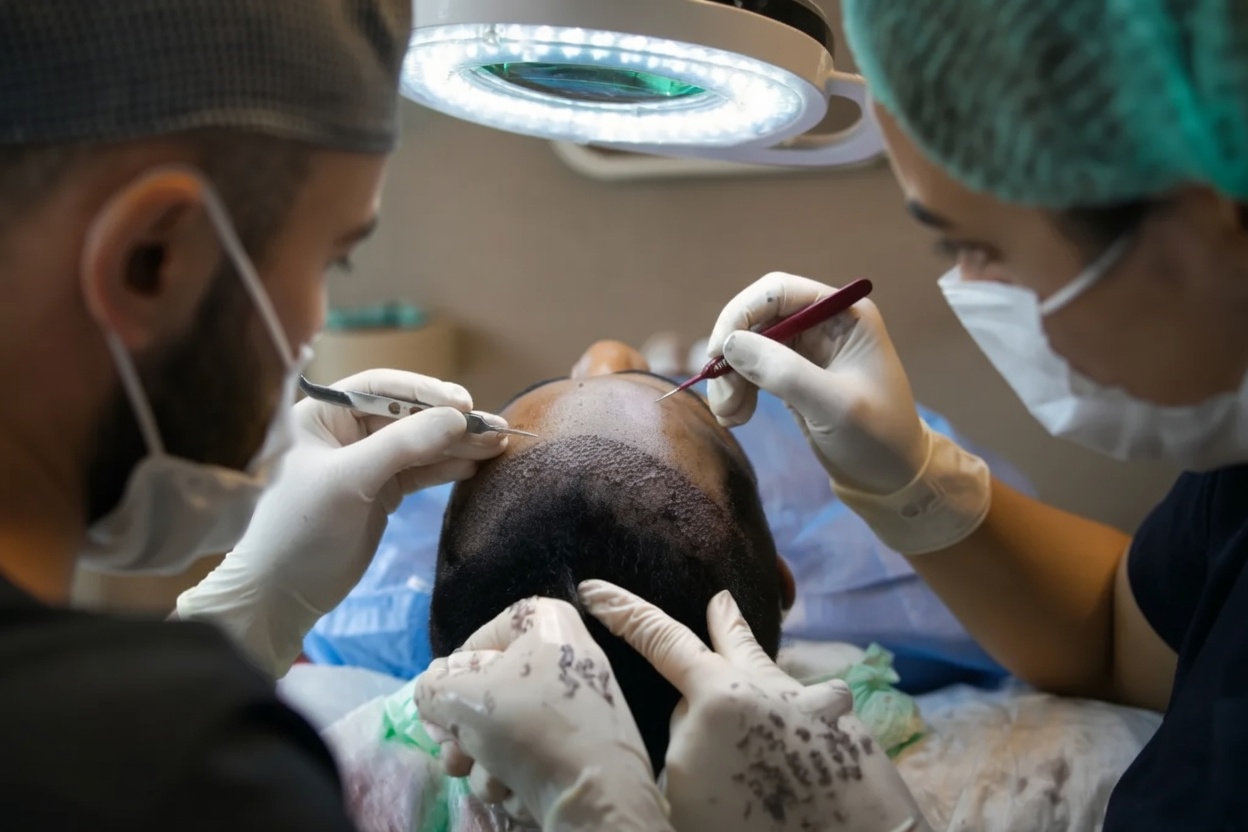 Hair transplant procedure